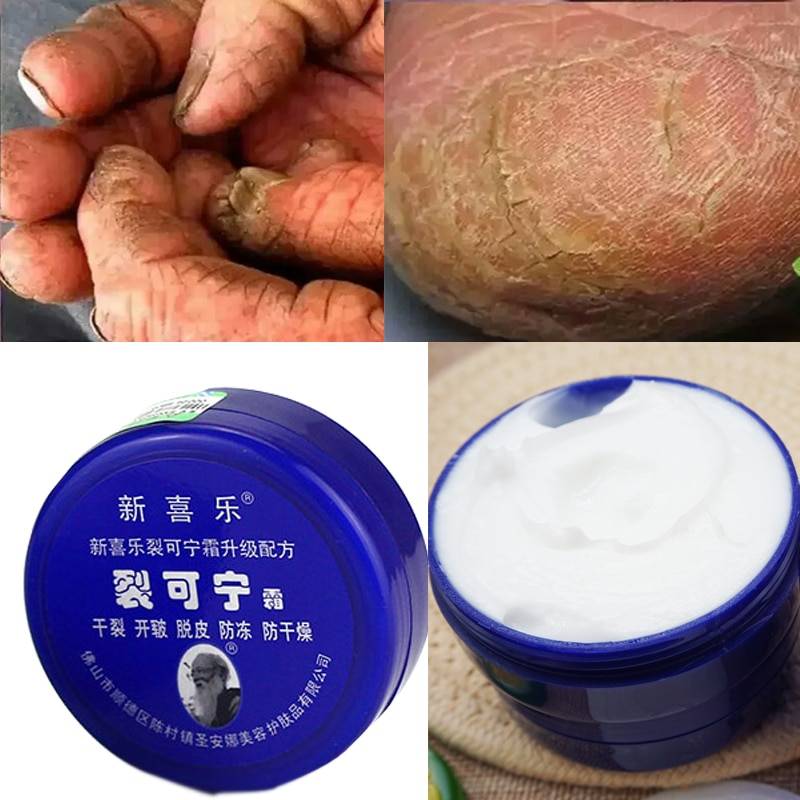 Anti Drying Crack Foot Cream Health & Beauty Ships From : China|Russian Federation Anti Drying Crack Foot Cream Health & Beauty Ships From : China|Russian Federation