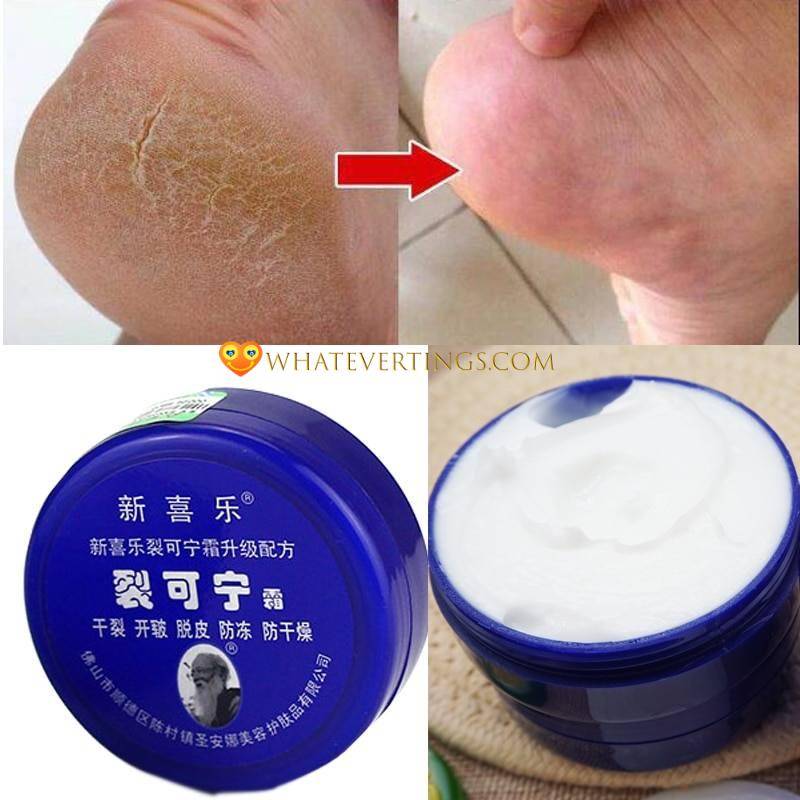 Anti Drying Crack Foot Cream Health & Beauty Ships From : China|Russian Federation Anti Drying Crack Foot Cream Health & Beauty Ships From : China|Russian Federation