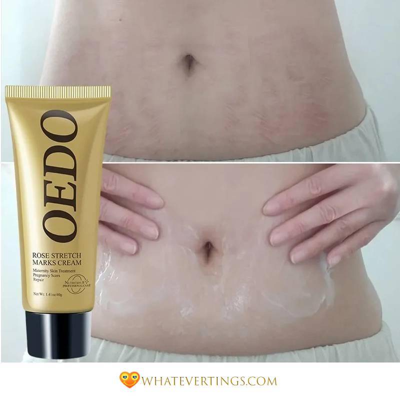 Stretch Mark Cream Health & Beauty Ships From : China|United States|Russian Federation Stretch Mark Cream Health & Beauty Ships From : China|United States|Russian Federation